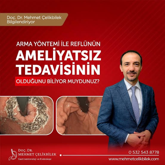 ARMA